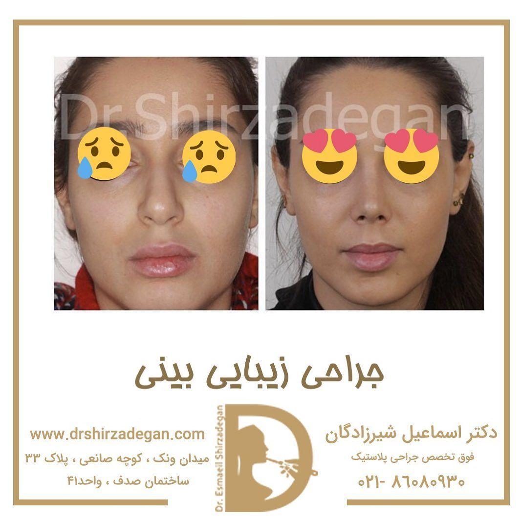 دکتر شیرزادگان