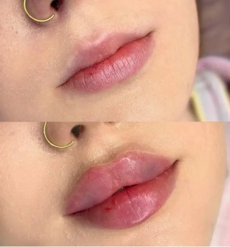 کلینیک زیبایی ،لیزر و لاغری گل مریم