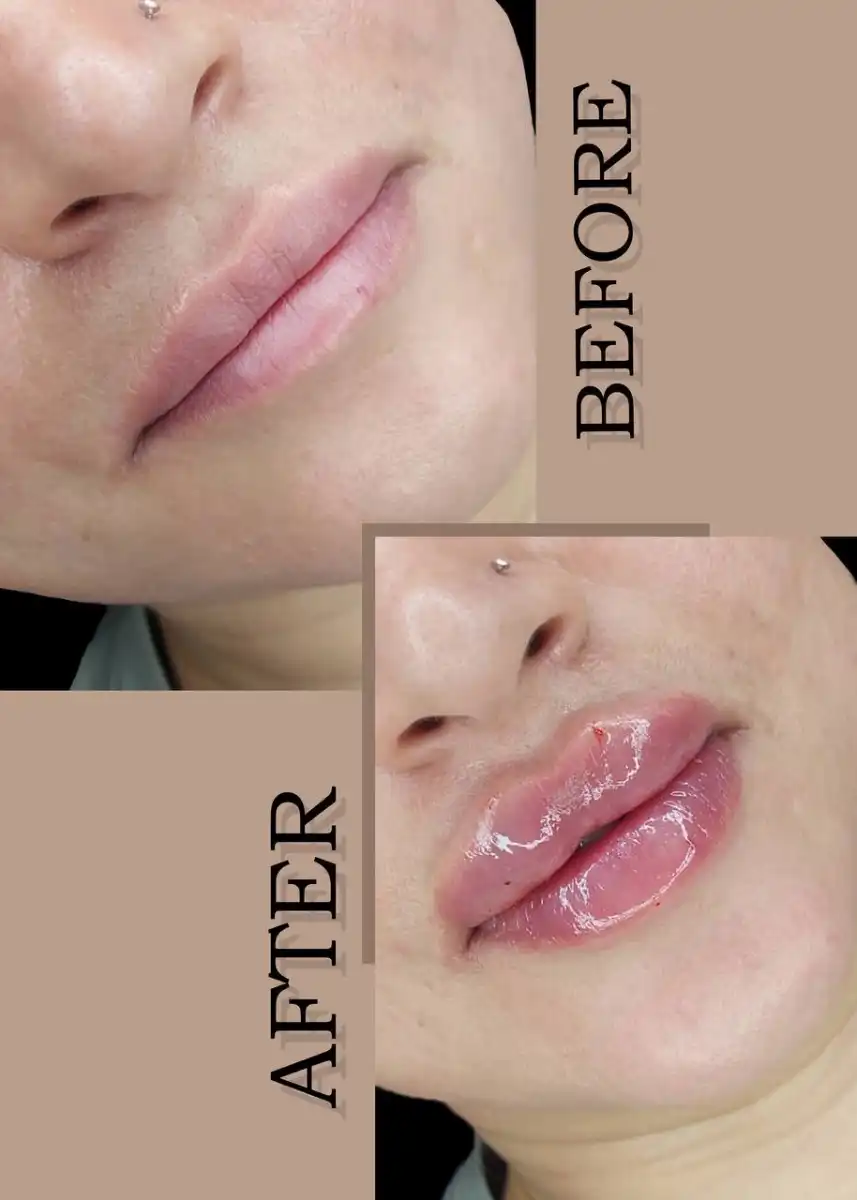 کلینیک زیبایی درناز (تخفیف ویژه لیزر)