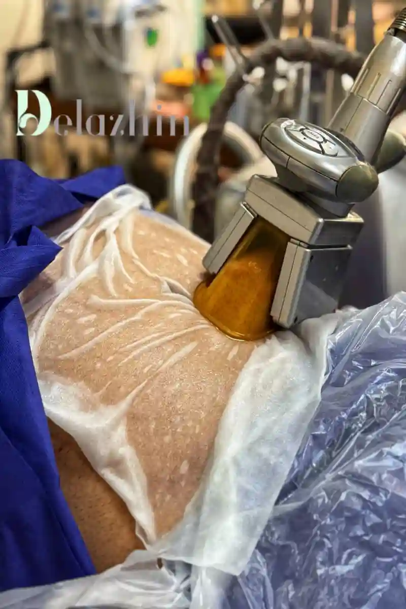 ماساژ، لاغری، پاکسازی پوست و مو (دلاژین)