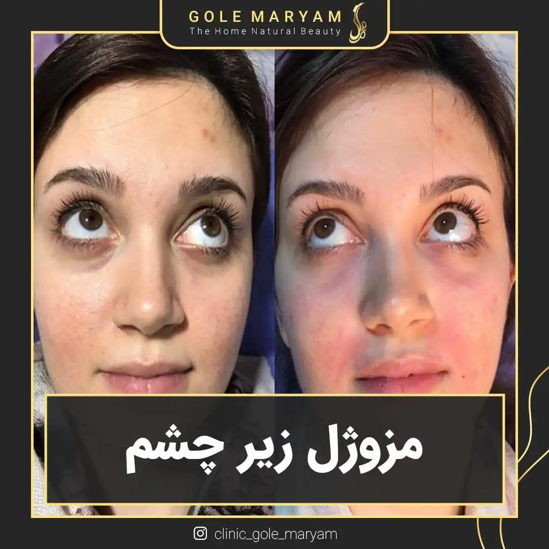 کلینیک زیبایی ،لیزر و لاغری گل مریم