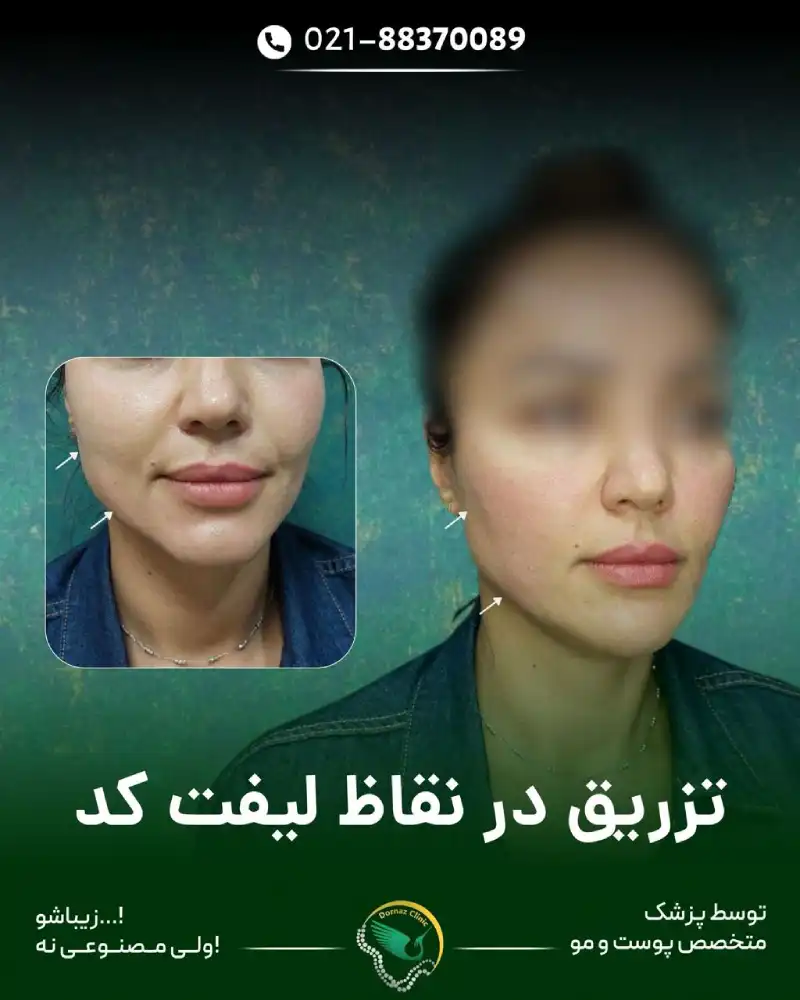 کلینیک زیبایی درناز (تخفیف ویژه لیزر)