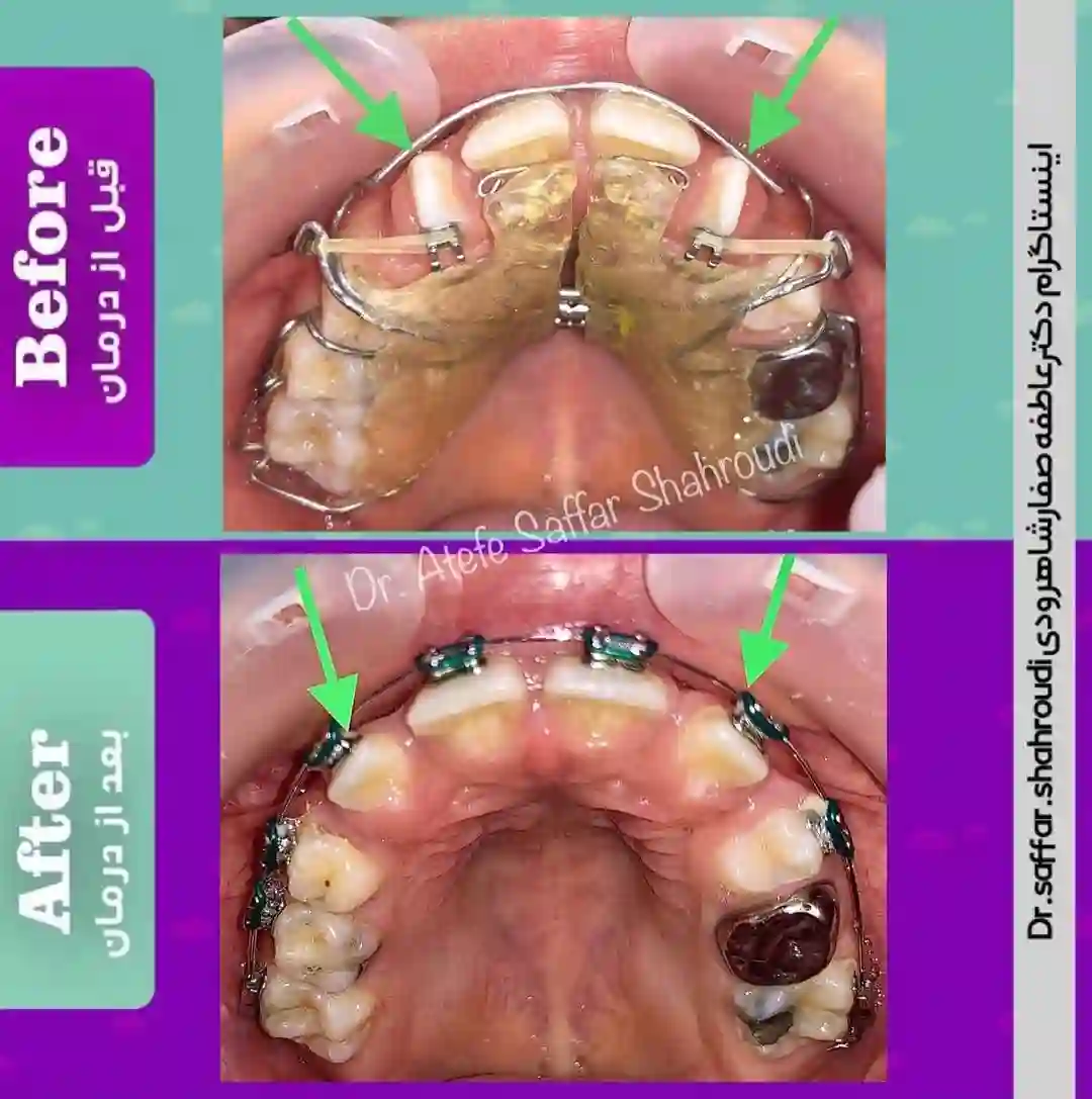متخصص ارتودنسی (دکتر عاطفه صفار شاهرودی)