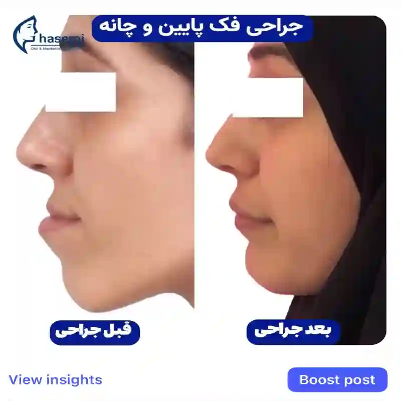 کلینیک جراحی فک و صورت دکتر قاسمی