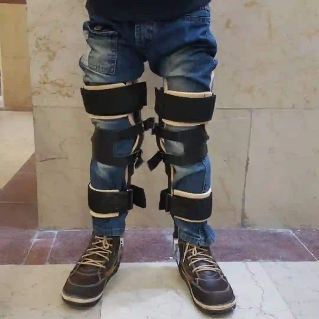 ارتوپدی فنی (ارتز پروتز) یاراطب