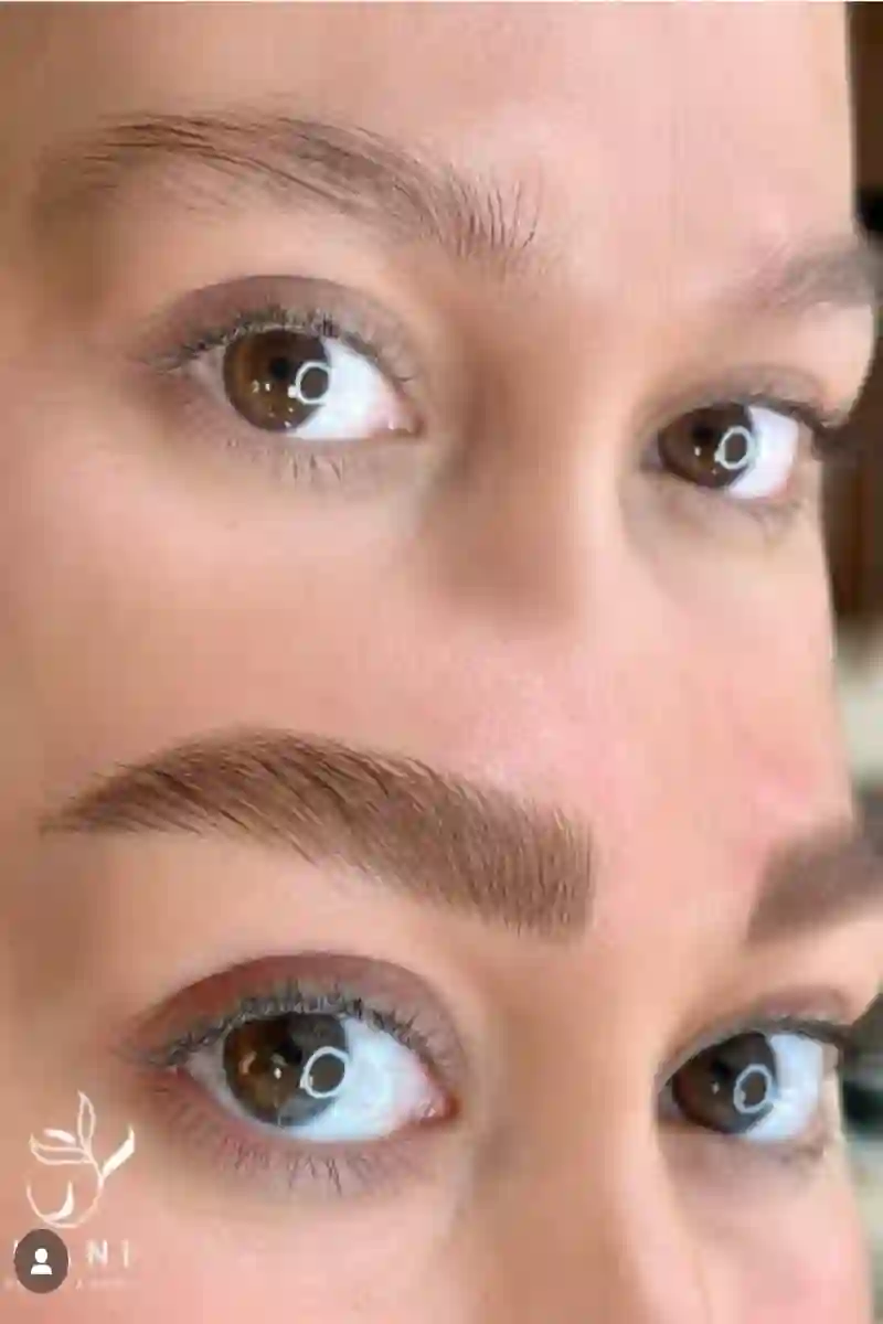 مرکز فوق تخصصی میکروبلیدینگ هانی