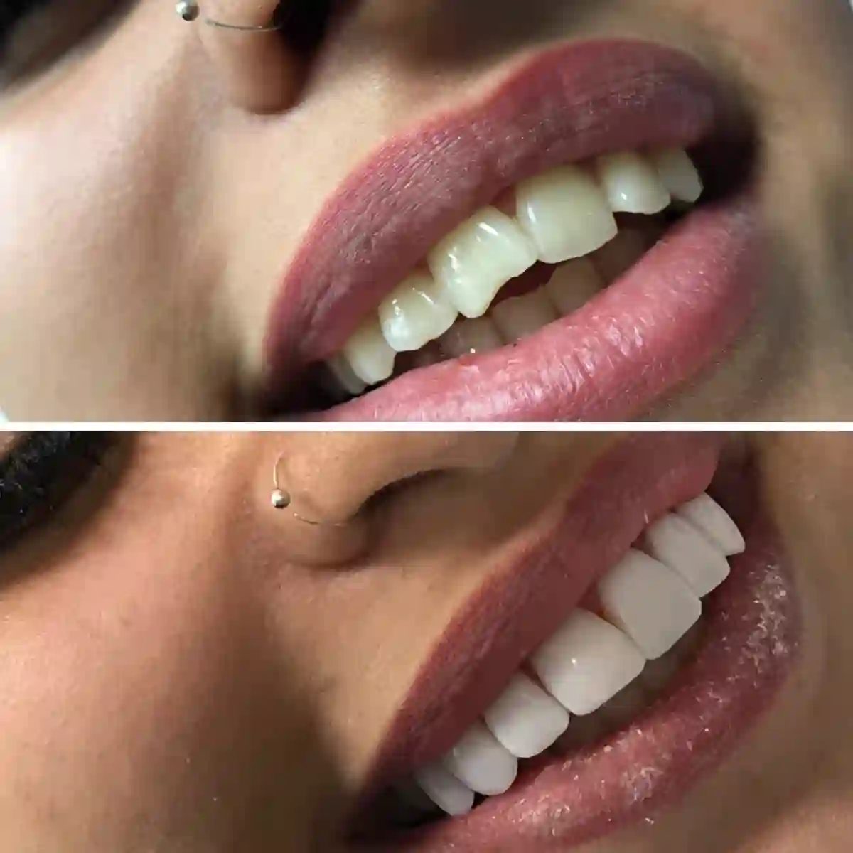 کلینیک دندانپزشکی مهرِنو