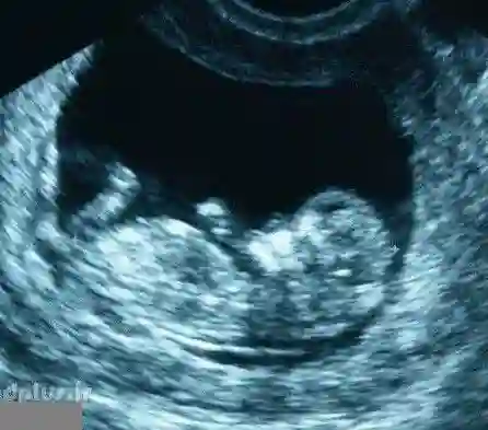 رادیولوژی سونوگرافی فرزانه