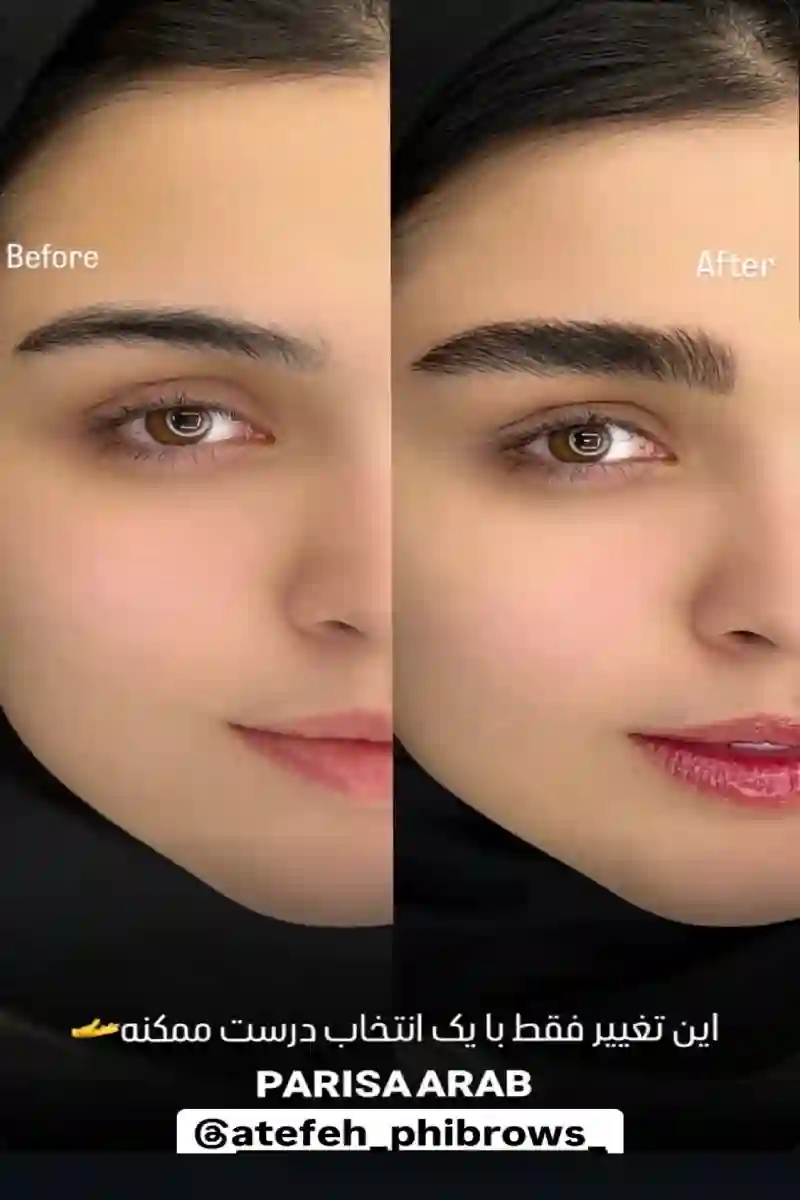 مرکز فیبروز و آرایش دائم عاطفه