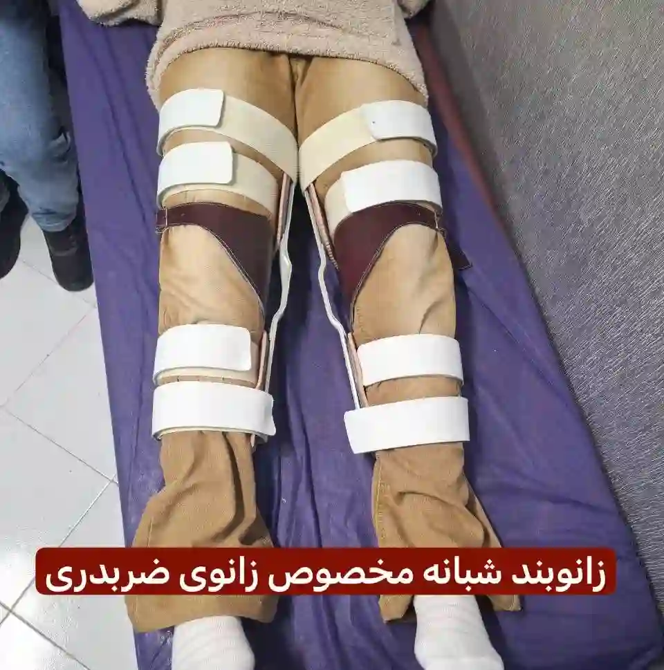 کلینیک ارتوپدی فنی ویام